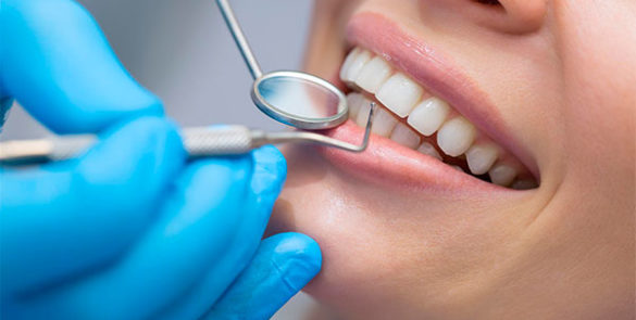 Лечение кариеса в стоматологии Перспектива | perspdent.ru